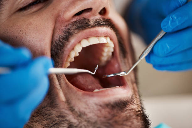 Best Chipped Tooth Repair Near Me  in Arvada, CO